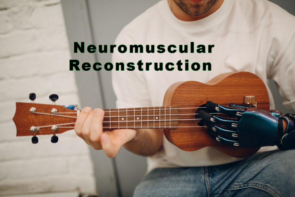 Neuromuscular Reconstruction