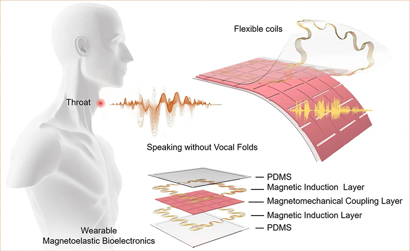 Illustration of wearable magnetoelastic bioelectronics for speaking without vocal folds, featuring components and placement on the throat.